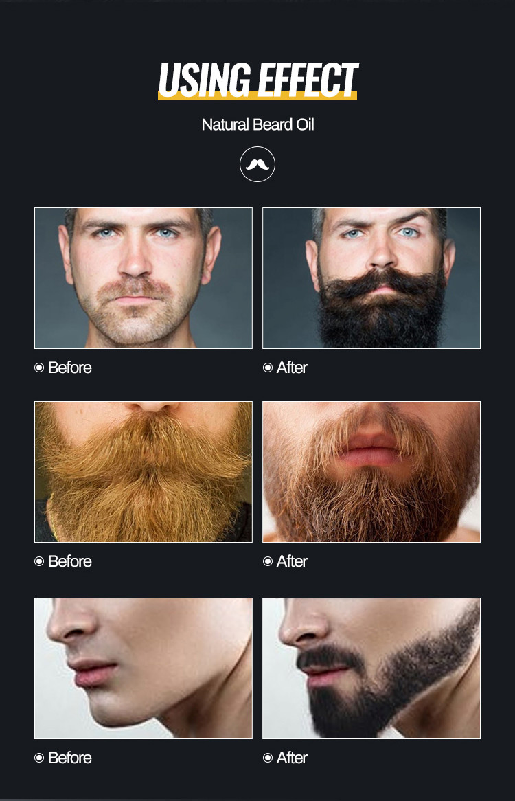 OEM Beard Growth Oil Beard Growth Softens Strengthens