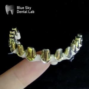 Wholesale Silver Gold Universal Pure Titanium Metal Frame Dental Customizable from china suppliers