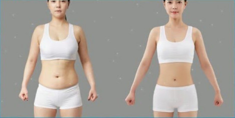 Body Contouring Power Assisted Liposuction Equipment For Body Sculpting Treatments