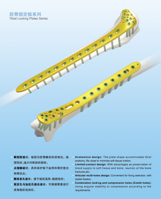 Plate and Screw Tibial Platform Lateral Plates II (L/R) Lower limbs Titanium Implate