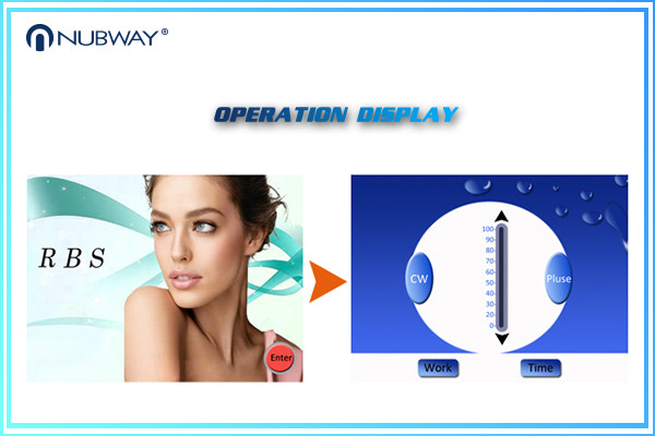 Chinese beauty equipment supplier spider vein skin tag removal vasculartreatment devices for spa clinice and salon use