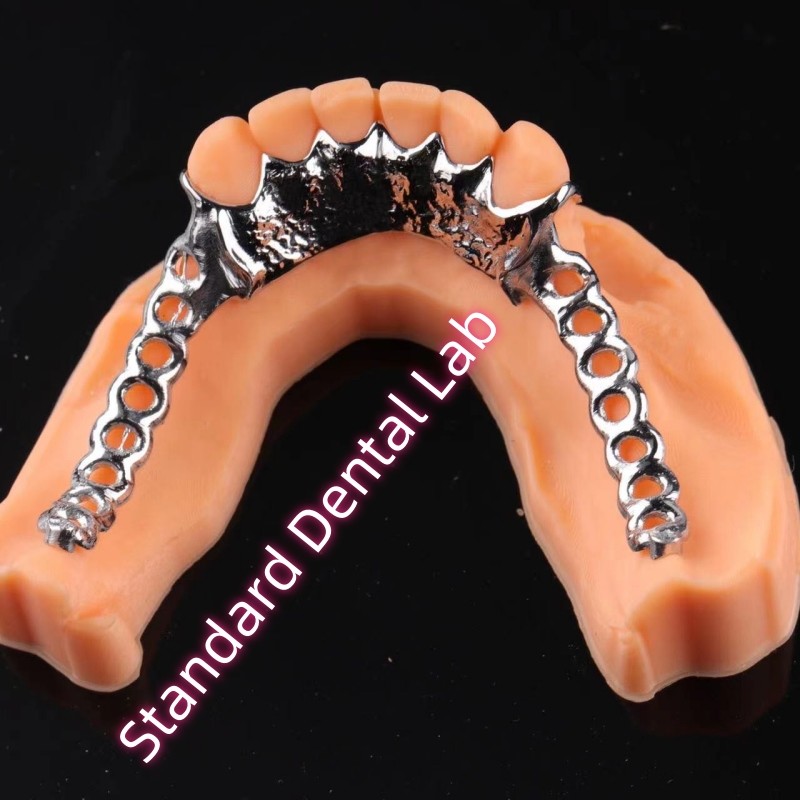 Laser Printing Cobalt Chrome Metal Framework Partial Denture Ni Be Free