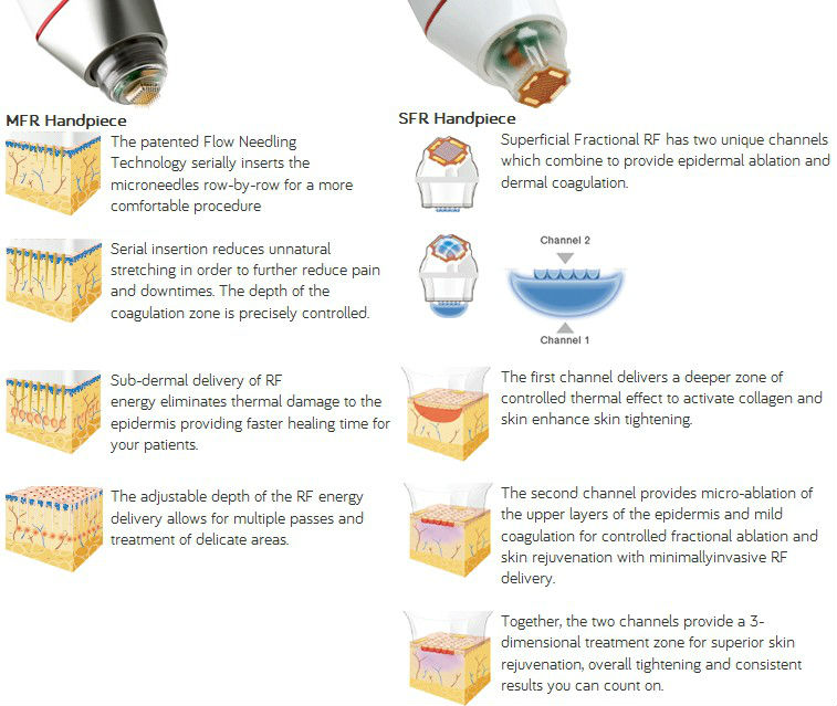 Fractional RF Microneedle Machine for wrinkle removal and skin rejuvenation
