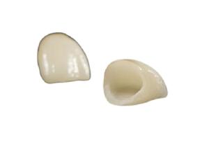 Wholesale Highly Biocompatible Ceramic Dental Crown Realistic Beautiful Colors Customized Size from china suppliers
