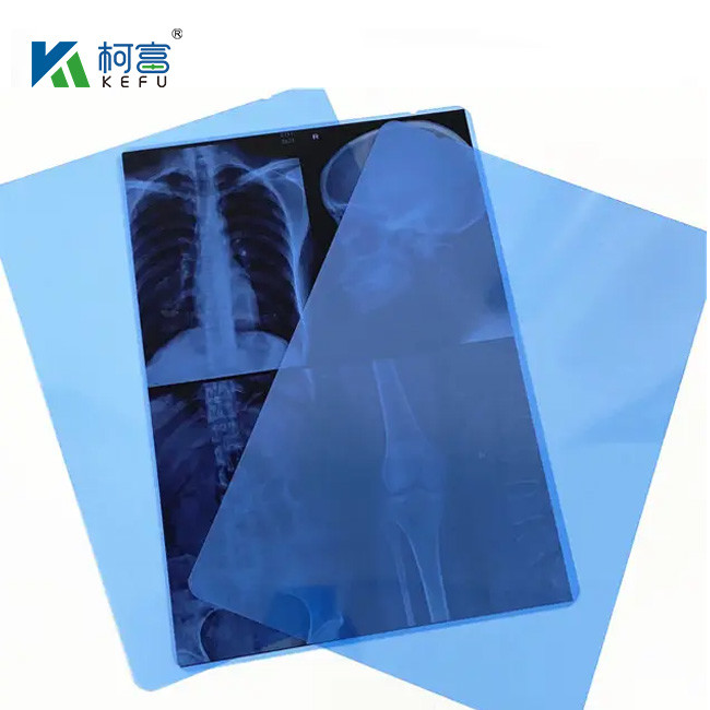 Customized Size Medical X Ray Film Blue Sensitive Medical X Ray Film Inkjet Medical Film