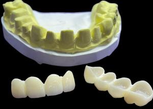 Wholesale Stain Resistant Dental Porcelain Crowns and Bridges in Vita Classical Shades for Natural Aesthetics from china suppliers