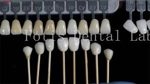 Wholesale Customization Natural Dental Veneers Fake Teeth Overlays High Strength from china suppliers