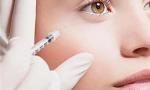 Hyaluronic Acid Lip Gel Injections Eye Wrinkle Synthetic Hyaluronic Acid Dermal