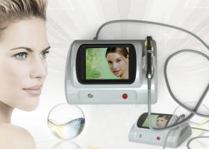 Wholesale 5MHz Fractional rf microneedle wrinkle removal / scar removal / stretch marks removal beauty machine from china suppliers