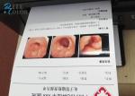 White Inkjet Medical Dry Imaging Film For Enteroscopy Ocular Fundus