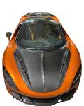 For McLaren 720S Carbon Fiber Hood 720S Upgraded Top-style Carbon Fiber Hood