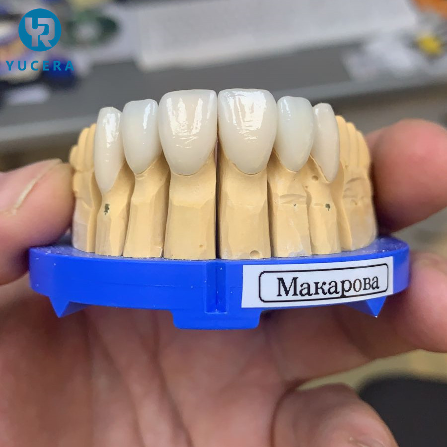 Yucera Multilayer Zirconia Block 25mm 1200HV 3D Pro Highly Esthetic