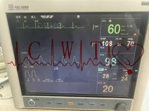 Wholesale ECG Mindray Mec 2000 Used Patient Monitor For ICU / Adult from china suppliers