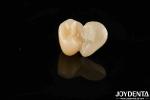 Emax Maryland Veneer Clinical Bonding Adhesion For Color Matching Dental Repair
