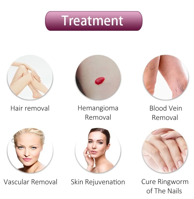1064nm Long Pulse Nd Yag Laser Machine Vascular Removal Permanent Hair Removal