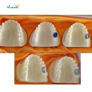 Wholesale Producing Steps Of Marilan Bridge Dental Study Models For Teeth Teaching from china suppliers