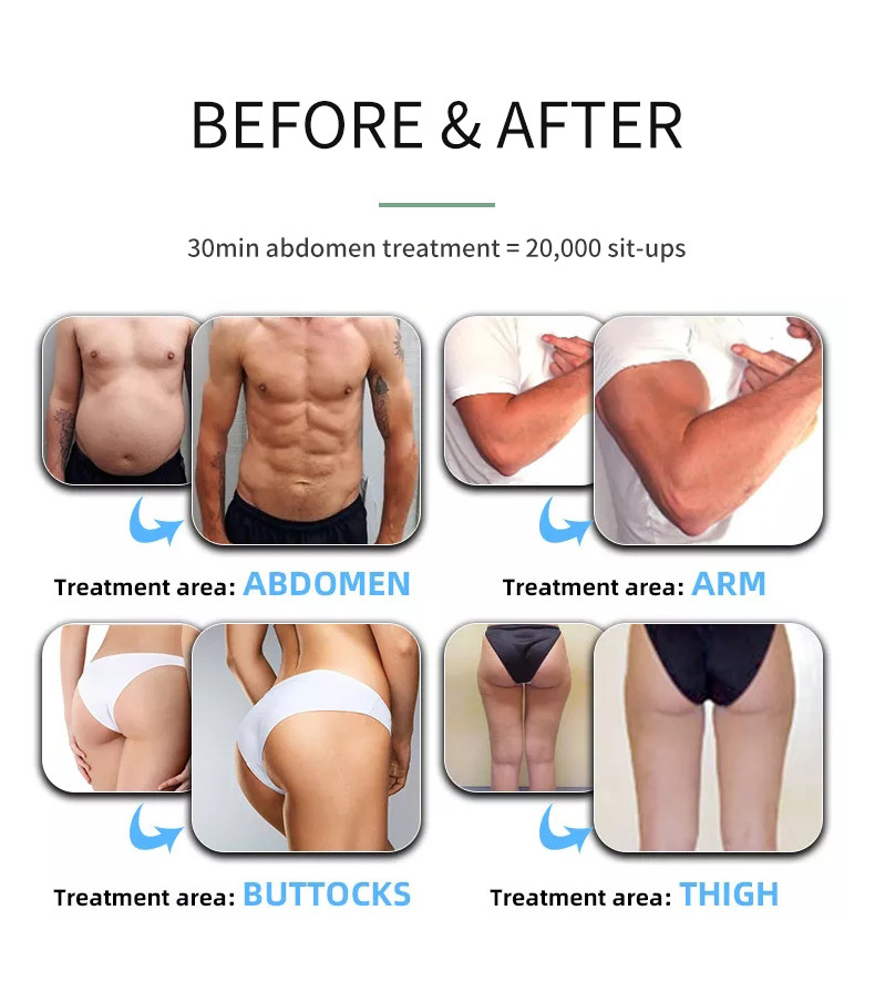 Slimming Non Invasive Body Contouring Machine Beauty High Intensity Device