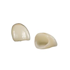 Wholesale High Stability Removable Dental Bridge High Biocompatibility Dental Implant Lab from china suppliers