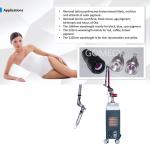 Q Switched Nd Yag Laser Body Machine Laser Skin Treatment Machine Eyebrow Tattoo