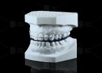 Adjustable Synthetic Activator Appliance In Orthodontics Functional Appliance