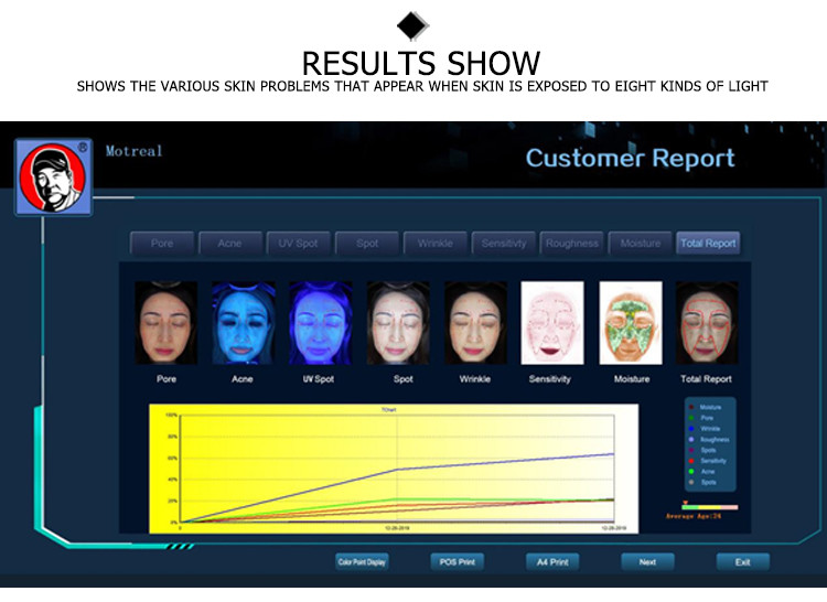 facial analysis machine analyzer vista scanner professional analyzer face analysis hd camera skin and scalp hir analyzer