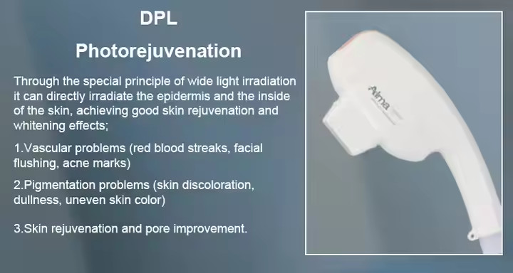 NIR Milk Light Whitening Hair Removal Machine Permanent Hair Remover Diode Laser 755 808 1064 Nm Diode Laser Hair Remover