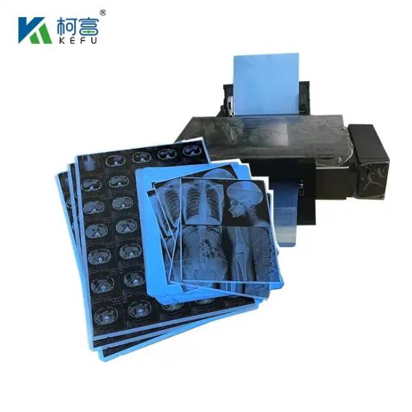 Medical Printing Radiology Universal Dry Film / 14*17 Inch Medical Blue Thermal
