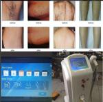 Permanently Painless 808nm Laser Hair Removal Machine Max 120J/Cm2