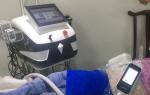 4 Handles Cryolipolysis Slimming Machine 600W Coolsculpting Cryolipolysis
