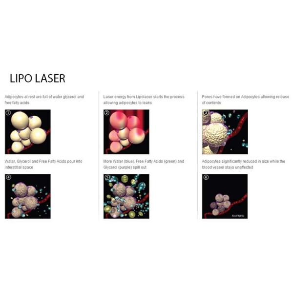 Multifunctional RF Beauty Equipment Fractional Rf & Lipolitico Laser Weight Loss Machines