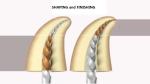 Nickel Titanium Niti Flexible Thermal Gold Files Rotary Type Heat - Activation