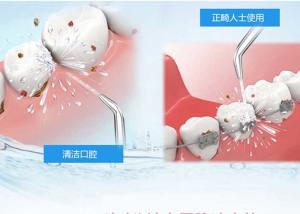 Wholesale High Frequency Personal Care Products 3 Modes Electric Dental Cleaning Devices from china suppliers