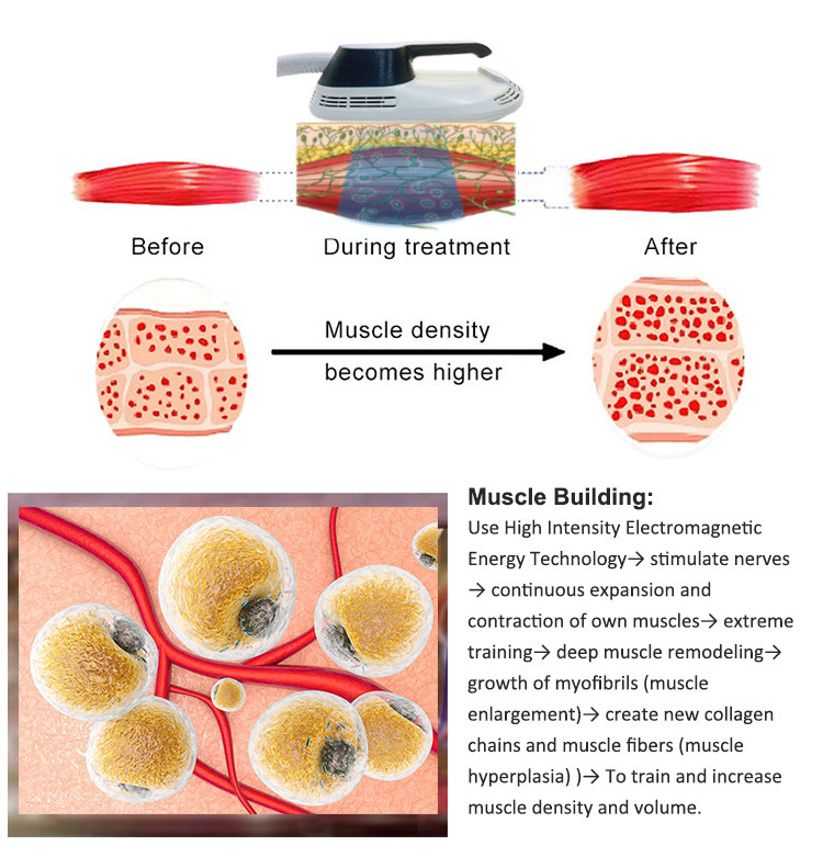 110V 220V Fat Cavitation Machine , Fat & Cellulite Removal Machine With Vibration Therapy Belt