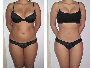 Weight Loss Ultrasonic Cavitation RF Slimming Machine 100W For Face / Body