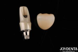Wholesale Zirconia Custom Abutments And Bars Dental Restorations For Individual Patient's Anatomy from china suppliers
