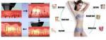Professional beauty equipment/devices manufacture diode laser hair removal south