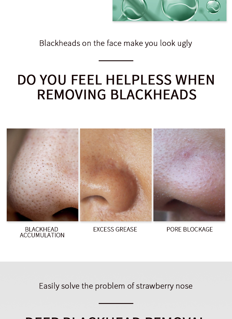 Reduce Growth Of Blackheads And Remove Oil Deep Cleaning White Nose Patch Blackhead Remover