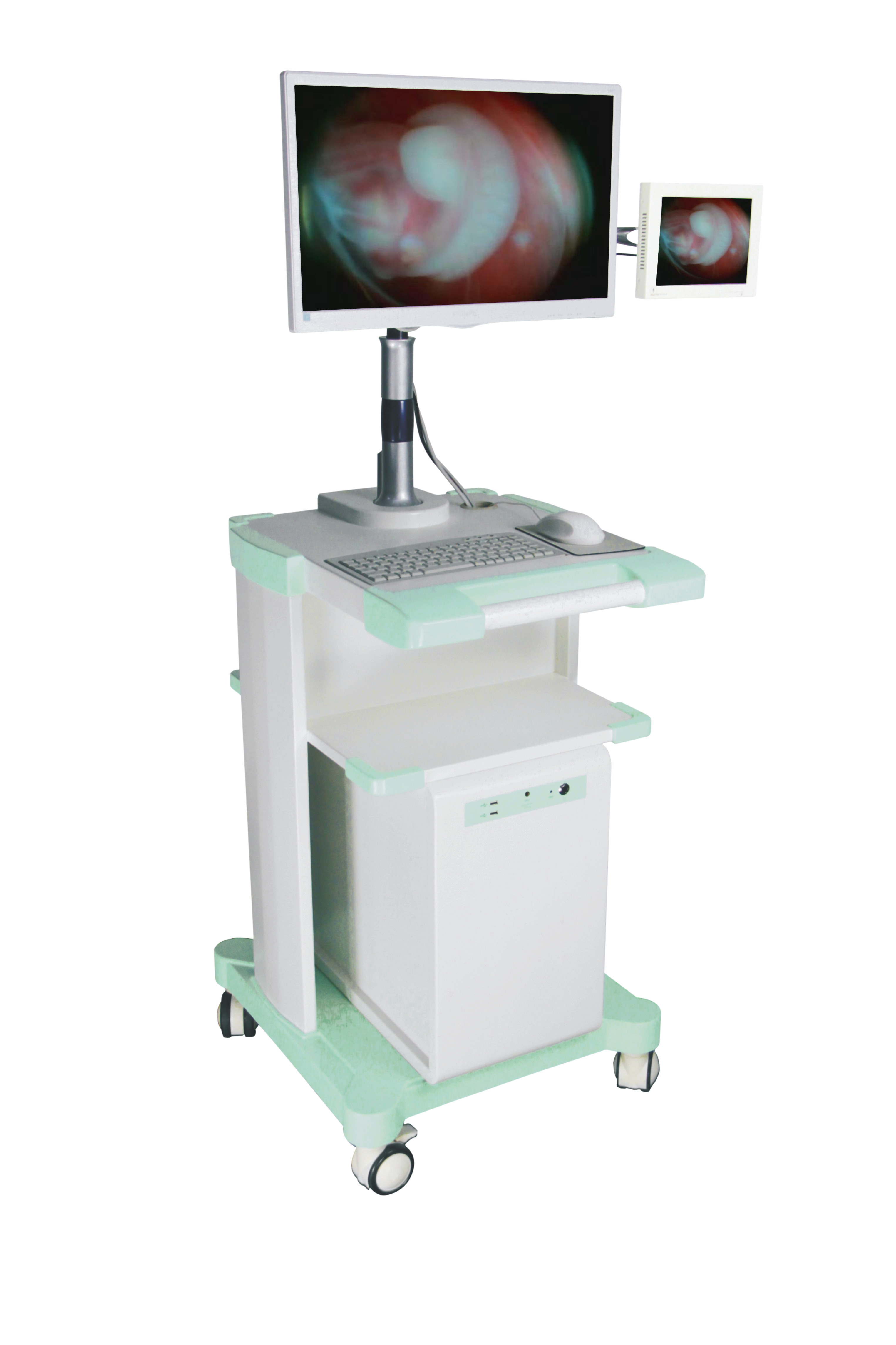CE/ISO Consumable Medical Devices Disposable Visual Endoscopic Suction Cannula