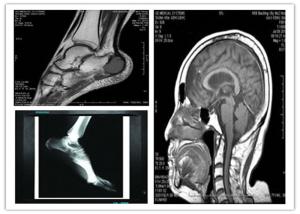 Wholesale Medical Digital Blue Base Dry Imaging Film 8 x 10in Compatible Hosipital Mri Scan from china suppliers
