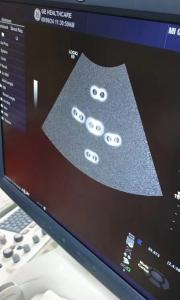 Wholesale Repair GE Ultrasound Parts ，GE Logiq E9 Ultrasonic MRX Board 5393908 from china suppliers