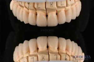 Wholesale Polished Layered Dental Zirconia 0.3-0.5mm Thickness With CAD CAM Technology from china suppliers