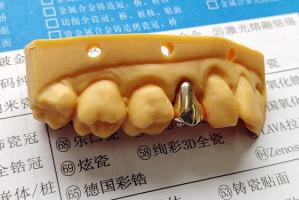 Wholesale High Noble Gold Full Metal Dental Crown from china suppliers