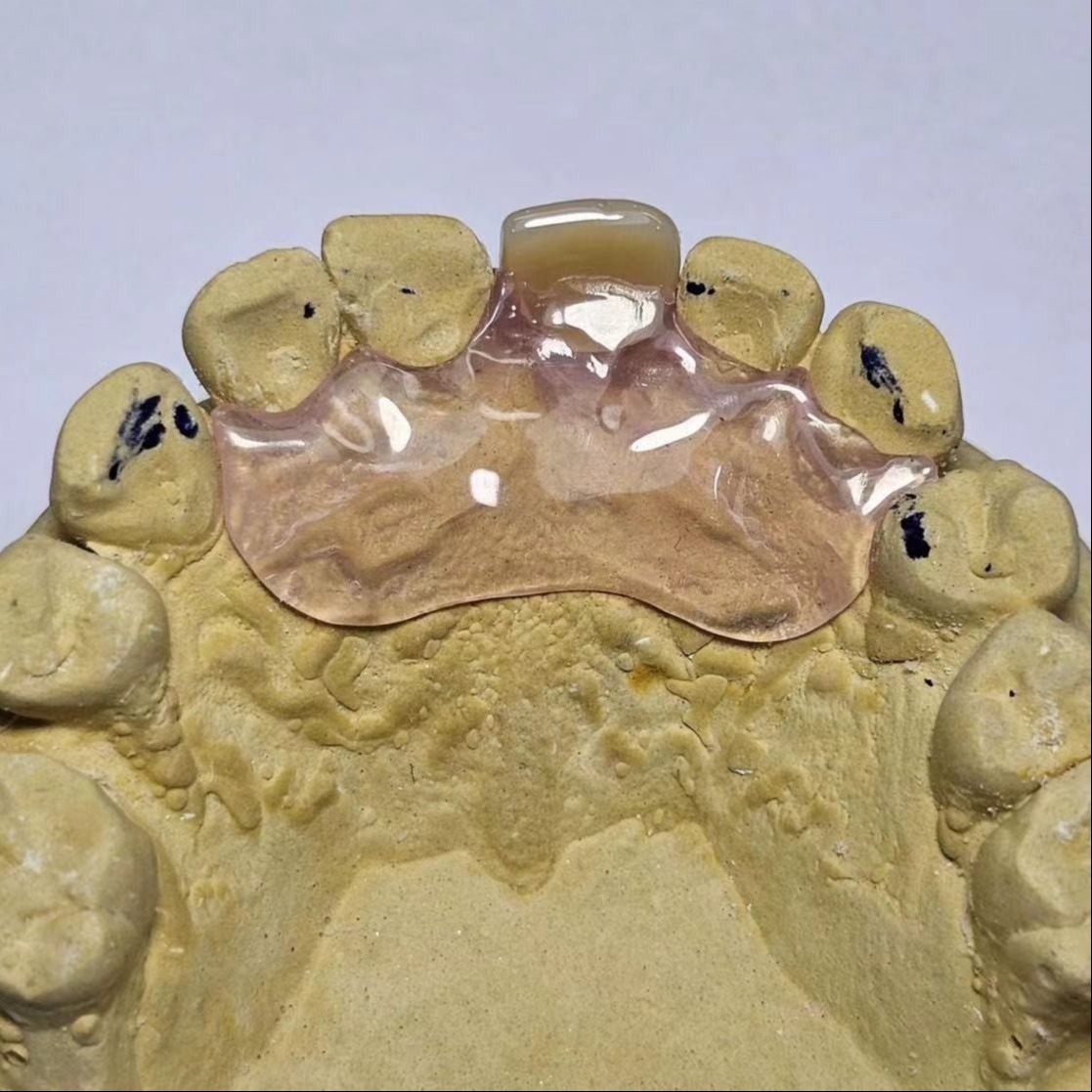 Dental TCS Valplast Flexible Partial Dentures Staining Fading Odors Resistant