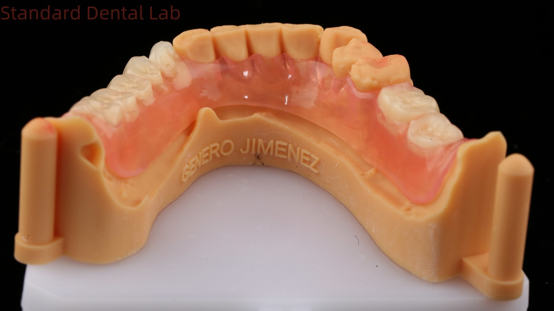 Dental TCS Valplast Flexible Partial Dentures Dental Lab 3D Print Model High Esthetics
