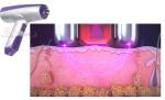 Rf Fractional Microneedle Rf Face Lifting Anti Wrinkle Machine