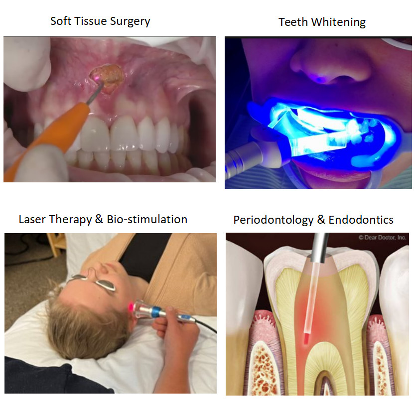 Multi Wavelength Soft Tissue Dental Diode Laser Equipment