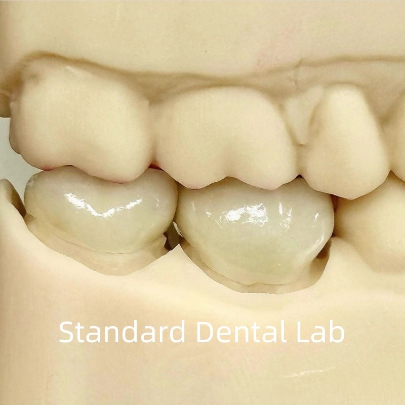Dental Lab Crowns Translucent Full Contour Zirconia With Superior Strength