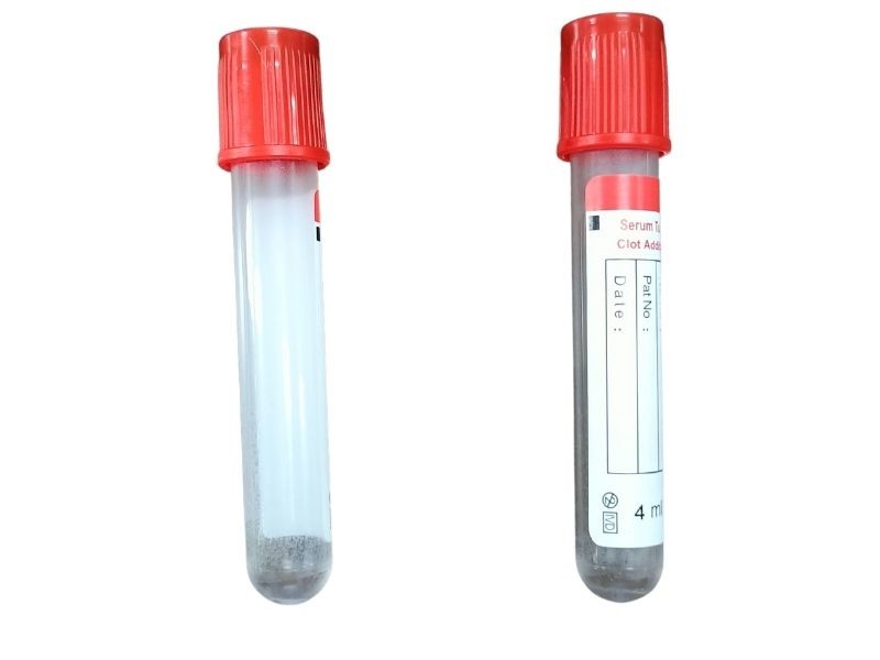Vacuum Pro Coagulant Test Tube Medical Accessory Blood Sampling 16*100mm