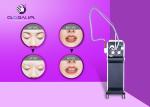 Portable ND YAG Laser Tattoo Removal Machine US506B