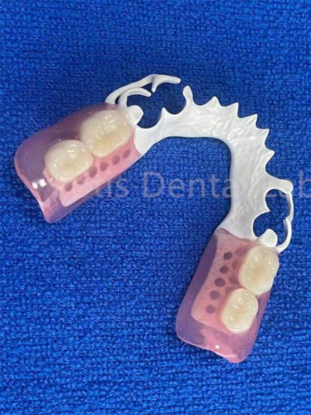 Adjustable Flexible Dental Prosthesis Stable Comfortable Immediate Partial